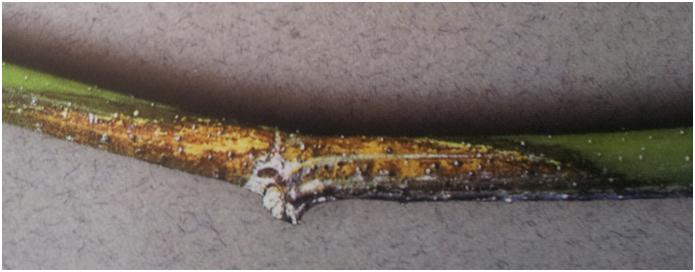 말채나무 가지마름병 caused by phomopsis macrospora. ver. 0.1